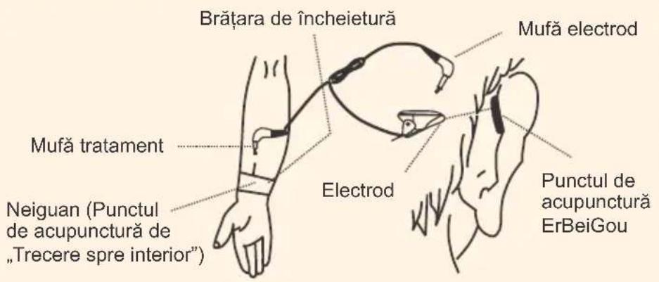 Brățara de încheietură Mufă electrod Mufă tratament Neiguan (Punctul de acupunctură de „Trecere spre interior") Electrod Punctul de acupunctură ErBeiGou