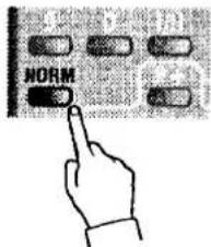 NORM