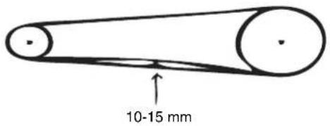 10-15 mm