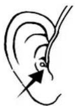 Widex Clear 440 C4-m - placera HörapparaT ocH individuell ear-Tip på/i öraT - 4