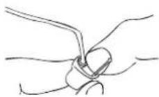 Widex Clear 440 C4-m - MONTERING, EAR-SET OCH INDIVIDUELL EAR-TIP - 2