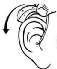 Widex Clear 440 C4-m - placera HörapparaT ocH individuell ear-Tip på/i öraT - 3