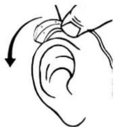 Widex Clear 440 C4-m - placera HörapparaT ocH ear-Tip på/i öraT - 1