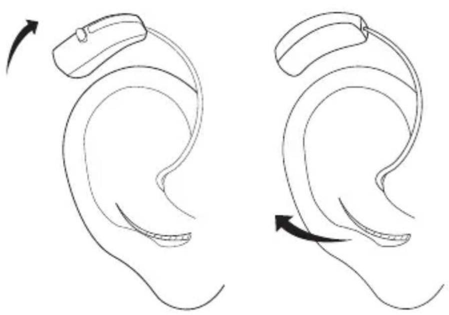 Widex Clear 440 C4-FS - Ta av hörapparaten - 1