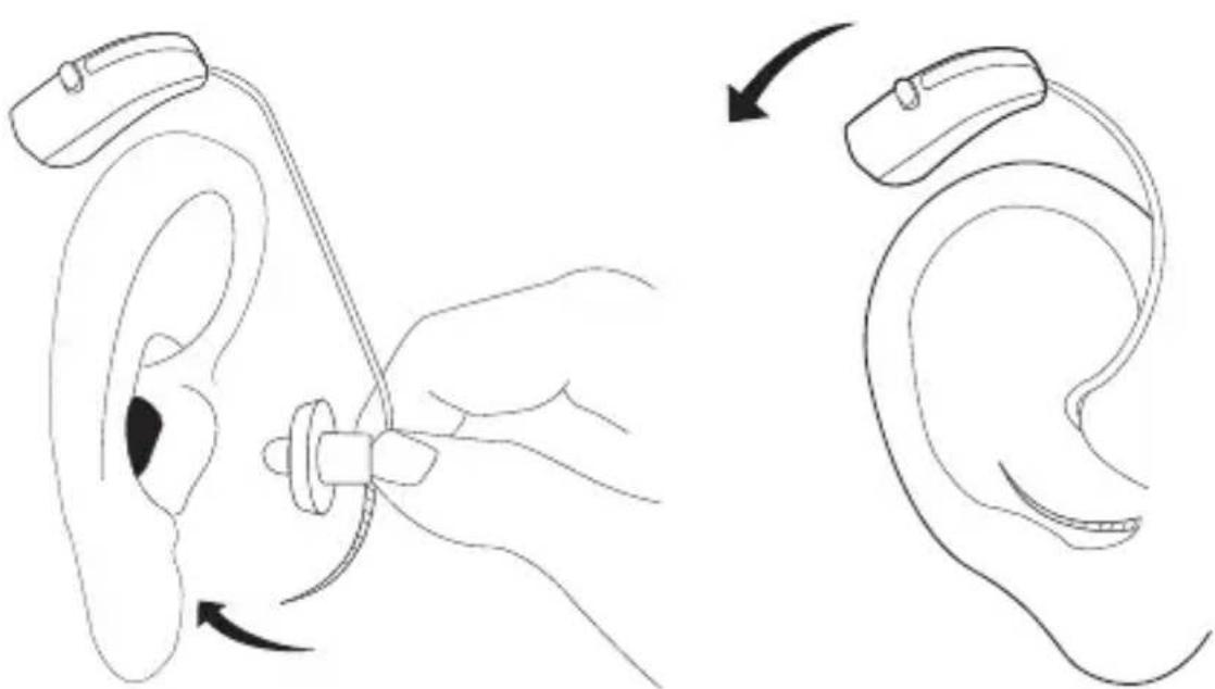 Widex Clear 440 C4-FS - Placera hörapparaten på örat - 1