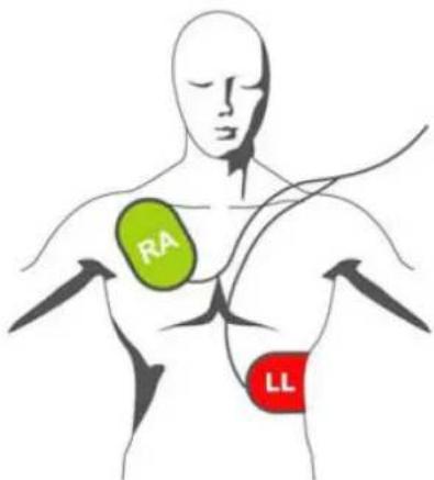 RA LL
