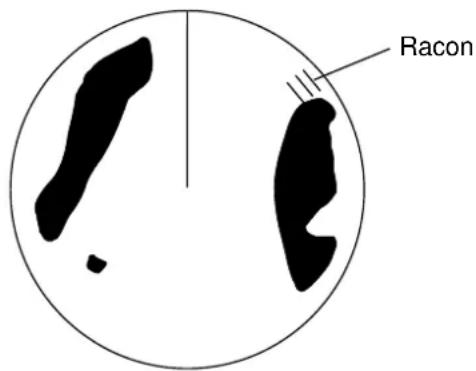 Racon