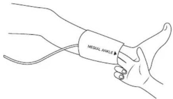 MEDUAL ANGLE