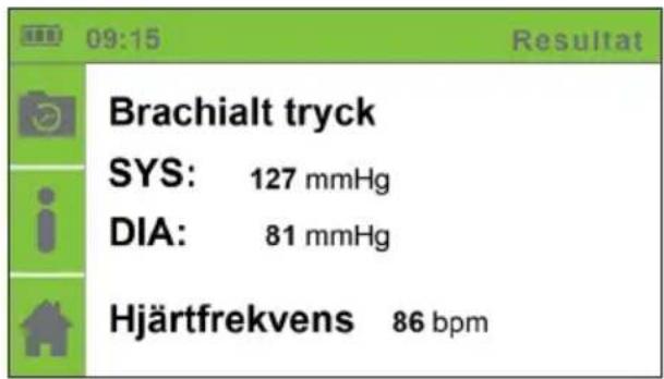 Brachialt tryck SYS: 127 mmHg DIA: 81 mmHg Hjärtfrekvens 86 bpm