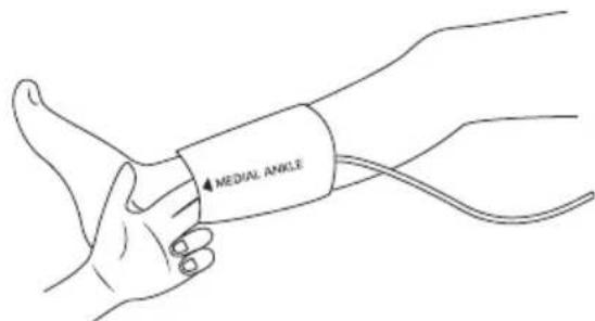 MEDIAL ANGLE