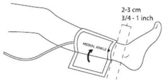 MESI ABPI-MD - Vänster ankelmanschett - 2