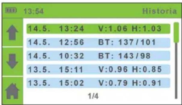 13:54 Historia 14.5. 13:24 V:1.06 H:1.03 14.5. 12:56 BT: 137/101 14.5. 10:32 BT: 143/98 13.5. 15:11 V:0.96 H:0.85 13.5. 15:02 V:0.79 H:0.91 1/4