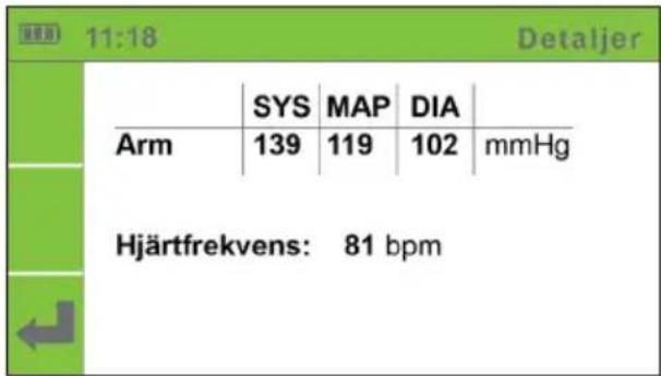 11:18 Detaljer SYS MAP DIA Arm 139 119 102 mmHg Hjärtfrekvens: 81 bpm