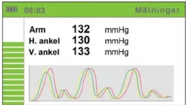 MESI ABPI-MD - OBSERVERA - 1