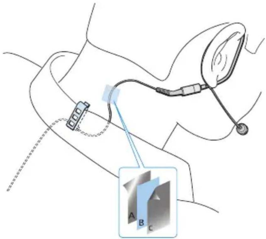 SENNHEISER Ear Set 1-4 - Attaching the connection cable to clothing - 2