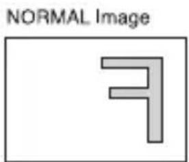 NORMAL Image