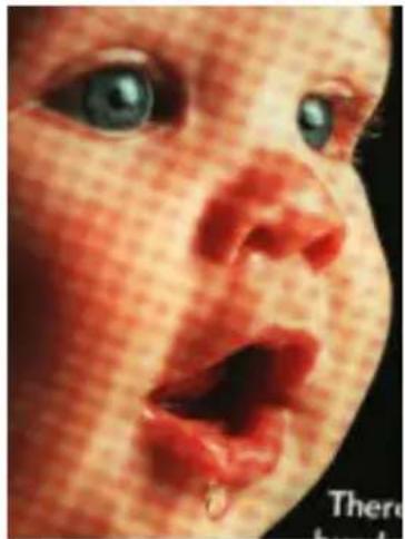 Close-up of a baby's face showing redness and absorption, with no visible text or symbols