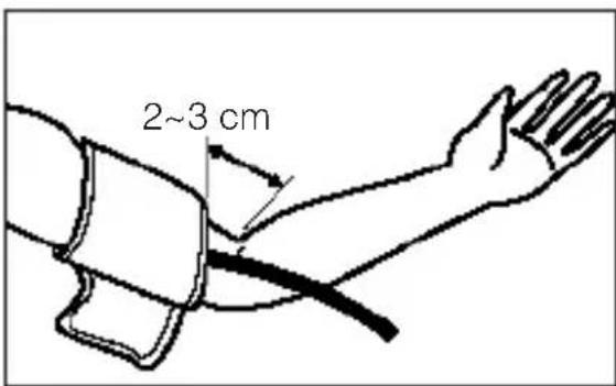 FAKIR Lutea - Attaching the Pressure Cuff - 2
