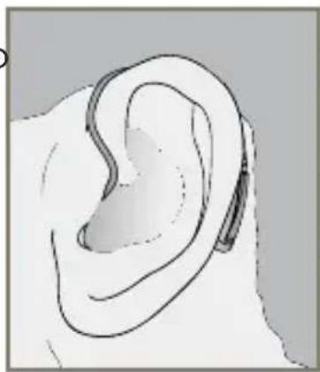 Starkey E Series RIC - To remove the Custom Eartip - 4