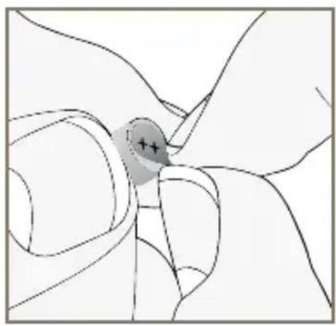 Starkey E Series RIC - To insert or replace the battery: - 2