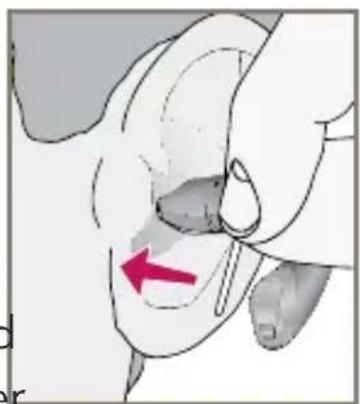 Starkey E Series RIC - To remove the Custom Eartip - 1