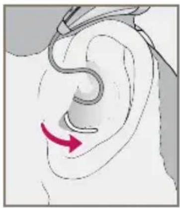 Starkey E Series RIC - To remove the Custom Eartip - 3