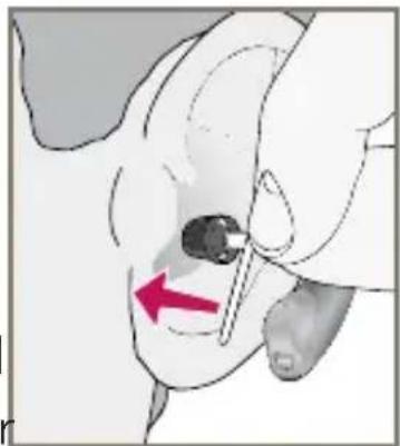 Starkey E Series RIC - To remove the Instant Fit Earbud - 1