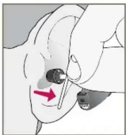 Starkey Destiny BTE mini - Insertion and Removal of Instant Fit Earbud or Custom Eartip - 6