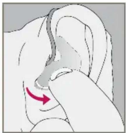 Starkey Destiny BTE mini - Insertion and Removal of Instant Fit Earbud or Custom Eartip - 3