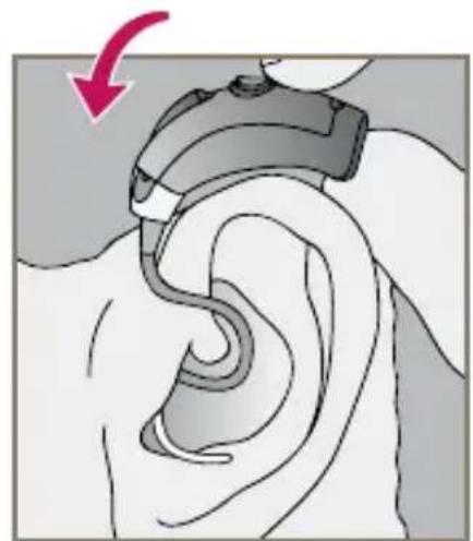 Starkey Destiny BTE mini - Insertion and Removal of Instant Fit Earbud or Custom Eartip - 5