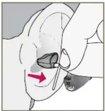Starkey Destiny BTE mini - To remove the hearing instrument and Custom Eartip: - 3