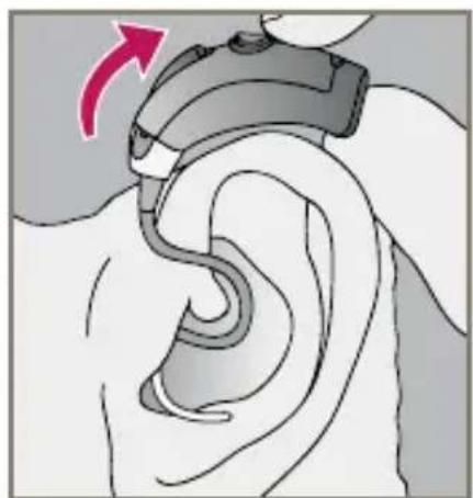 Starkey Destiny BTE mini - Insertion and Removal of Instant Fit Earbud or Custom Eartip - 2