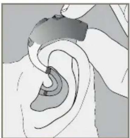 Starkey Destiny BTE mini - Custom Earmold - 5