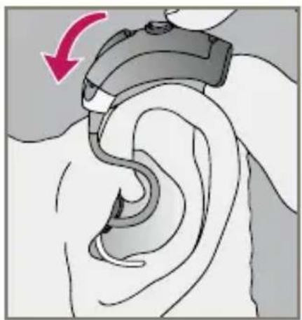Starkey Destiny BTE mini - To remove the hearing instrument and Custom Eartip: - 2