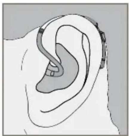 Starkey Destiny BTE mini - Custom Earmold - 6