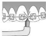 PANASONIC EW-TDEF4 - How to apply/move the toothbrush - 4