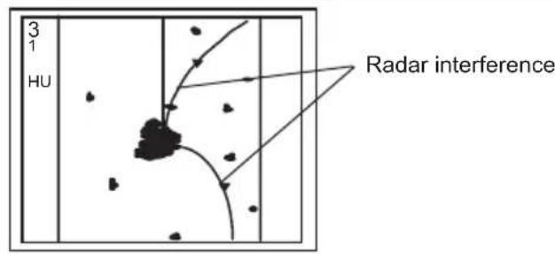 3 1 HU Radar interference