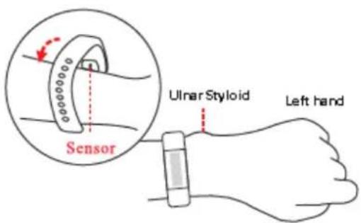 Sensor Ulnar Styloid Left hand