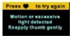 Zipy GO Beating Plus - Note: - 1
