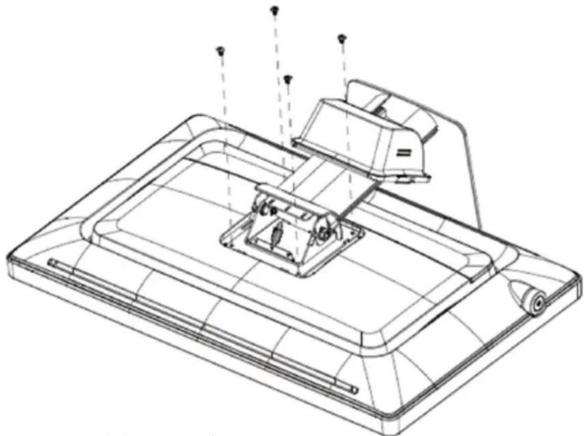 Baaske Medical e-medic 22AM+ - Stand removal & VESA mount installation - 2
