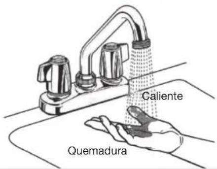 Caliente Quemadura