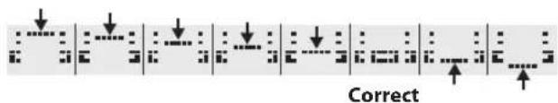 ROLAND TD-4SX - While you watch the meter that's shown in the lower part of the screen, turn the VH-11's VH offset adjustment screw to adjust it. - 1