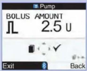 BOLUS AMOUNT 2.5 U Exit Back