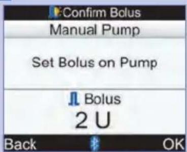 Confirm Bolus Manual Pump Set Bolus on Pump Bolus 2 U Back OK