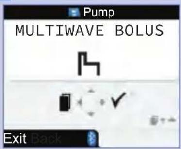 Pump MULTIWAVE BOLUS Exit Back