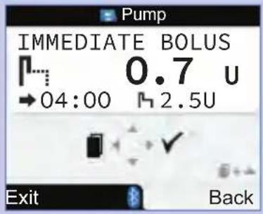 Pump IMMEDIATE BOLUS 0.7 u → 04:00 2.5U Exit Back