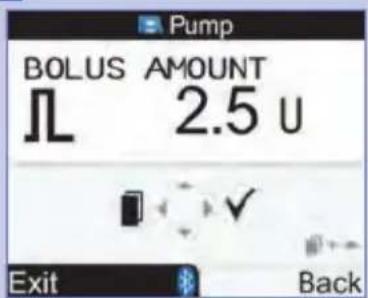 BOLUS AMOUNT 2.5 U Exit Back