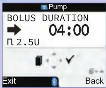 BOLUS DURATION 04:00 2.5U Exit Back