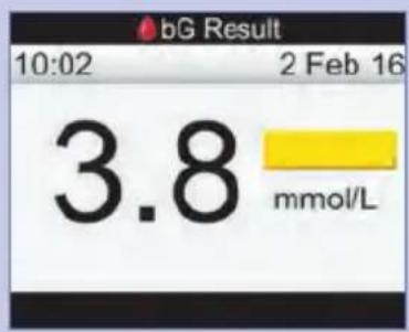 bG Result 10:02 2 Feb 16 3.8 mmol/L