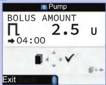 BOLUS AMOUNT Π 2.5 u →04:00 Exit Back